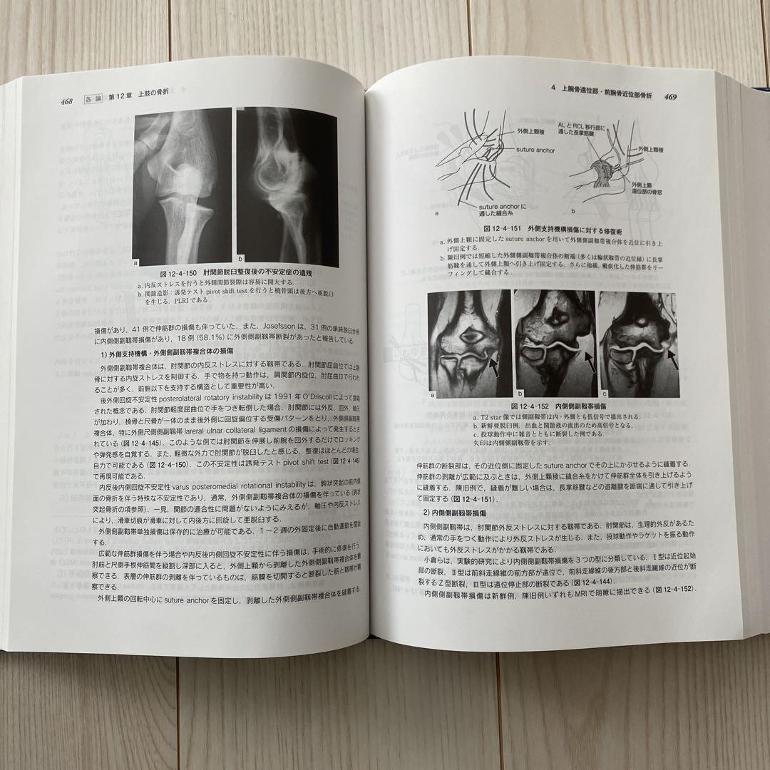 脱臼