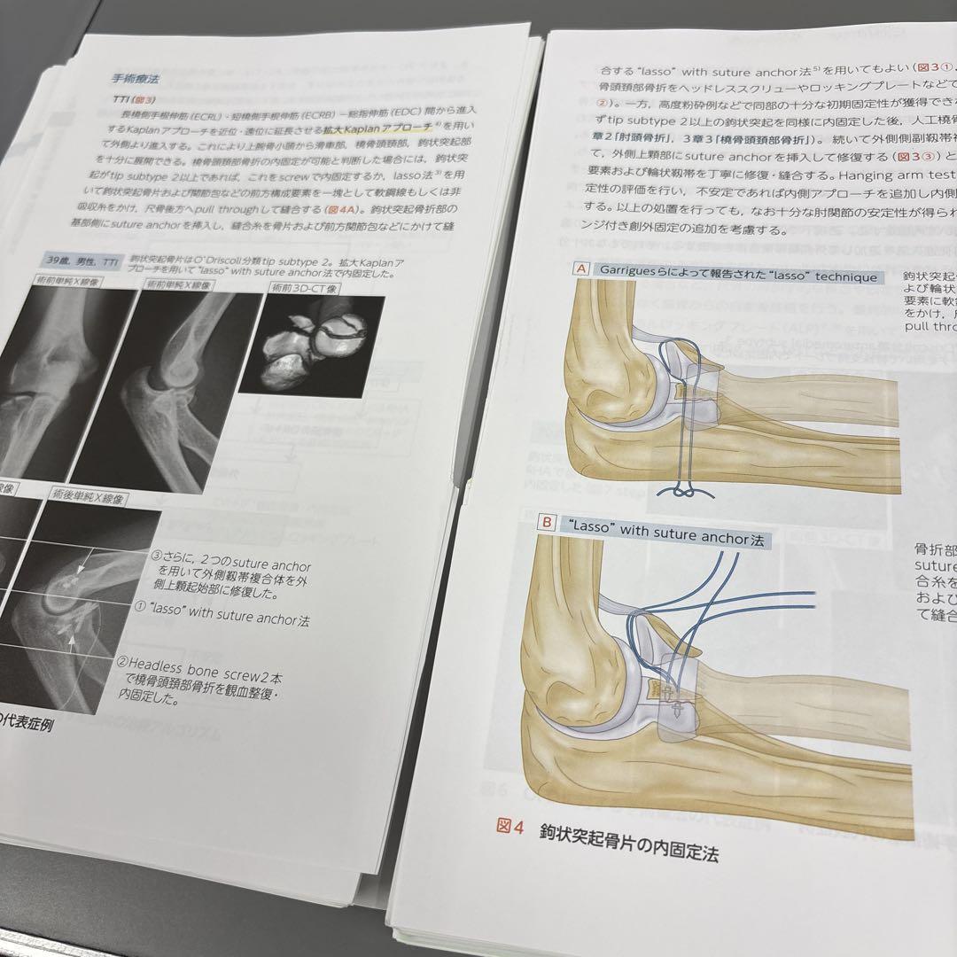 【裁断】レジデントのための整形外科診療 上肢