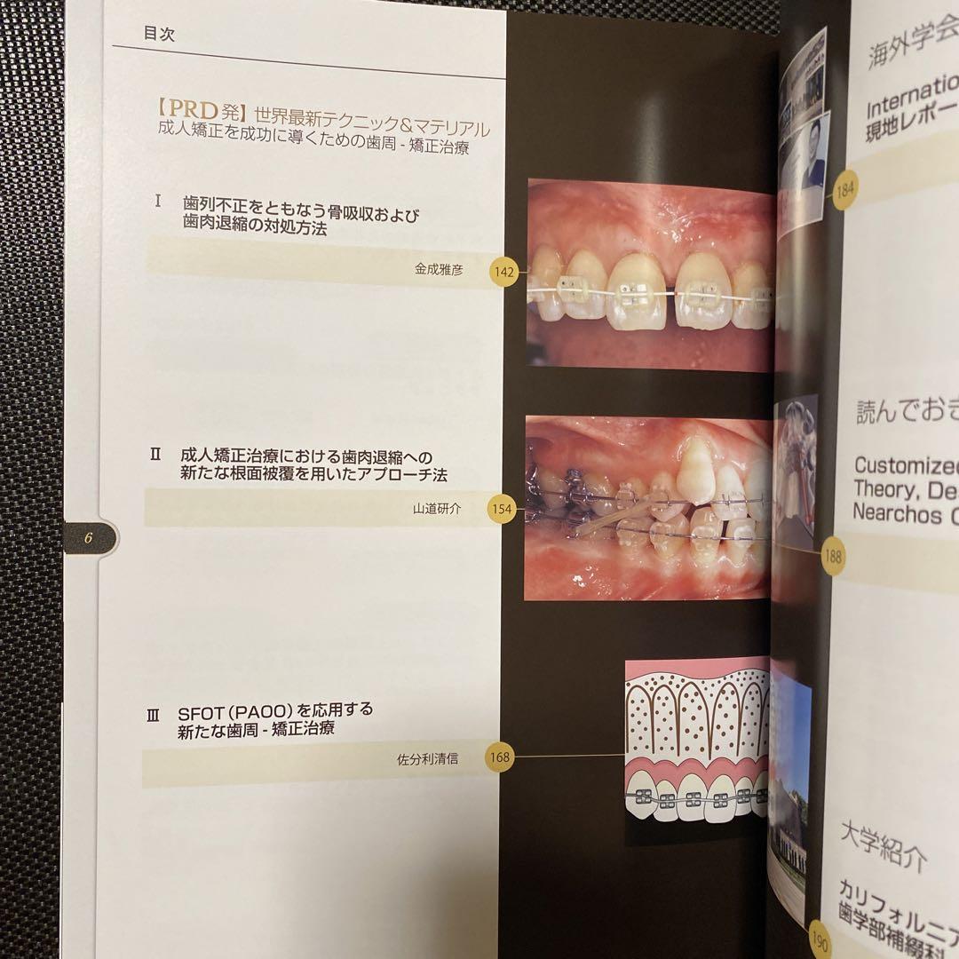 別冊.ザ クインテッセンス PDR2023 成人矯正を成功に導く為の歯周矯正治療