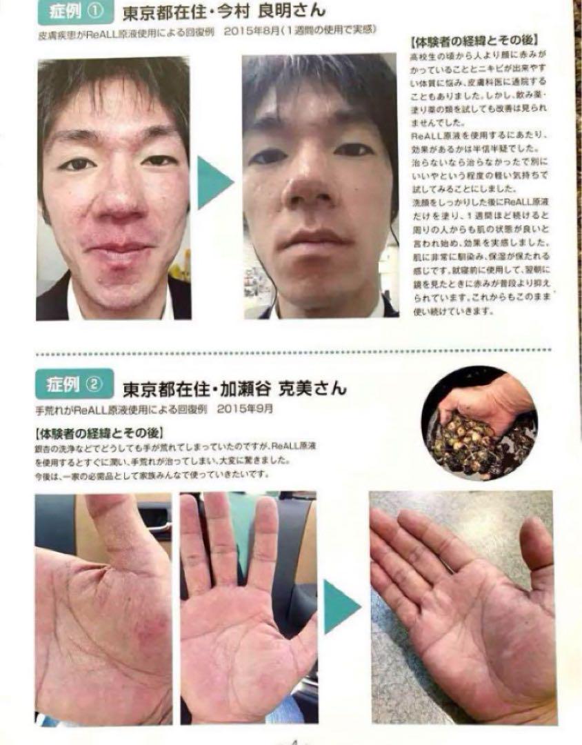 肌荒れ・アトピー肌を救え！リオールモイスチャー！ | 宮崎で肌