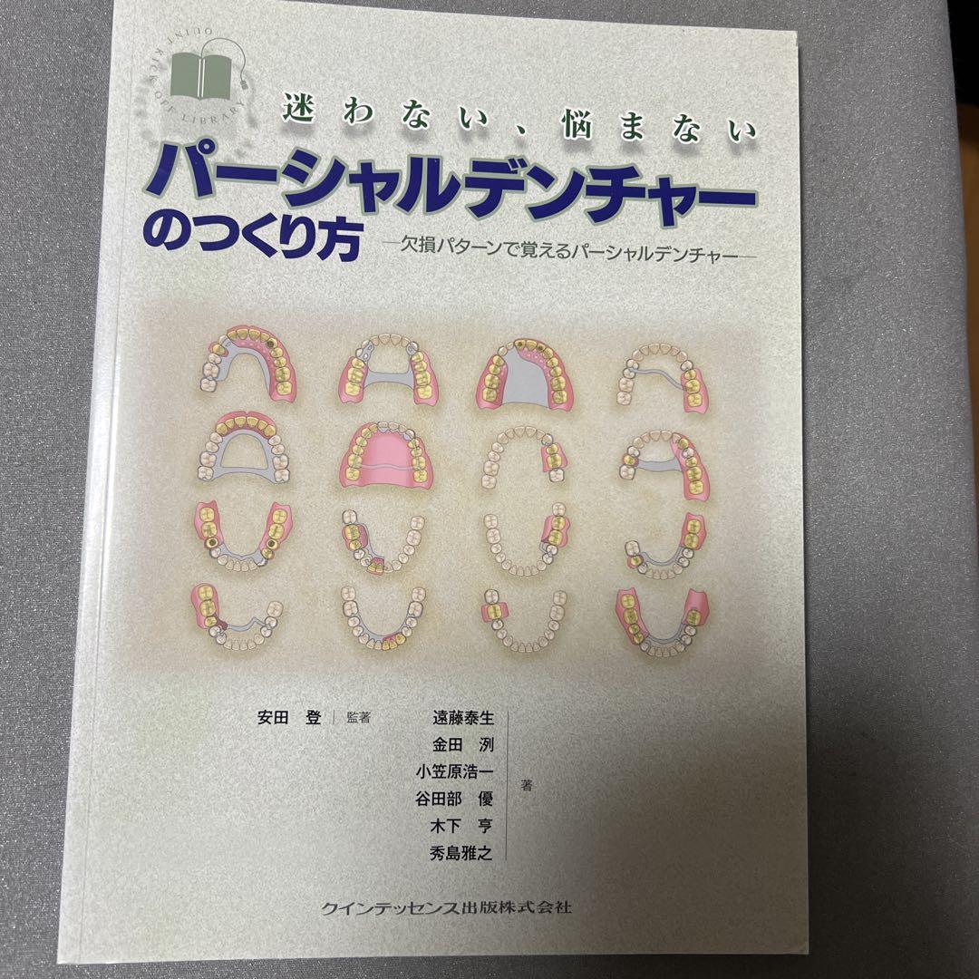 迷わない、悩まないパーシャルデンチャーのつくり方 : 欠損