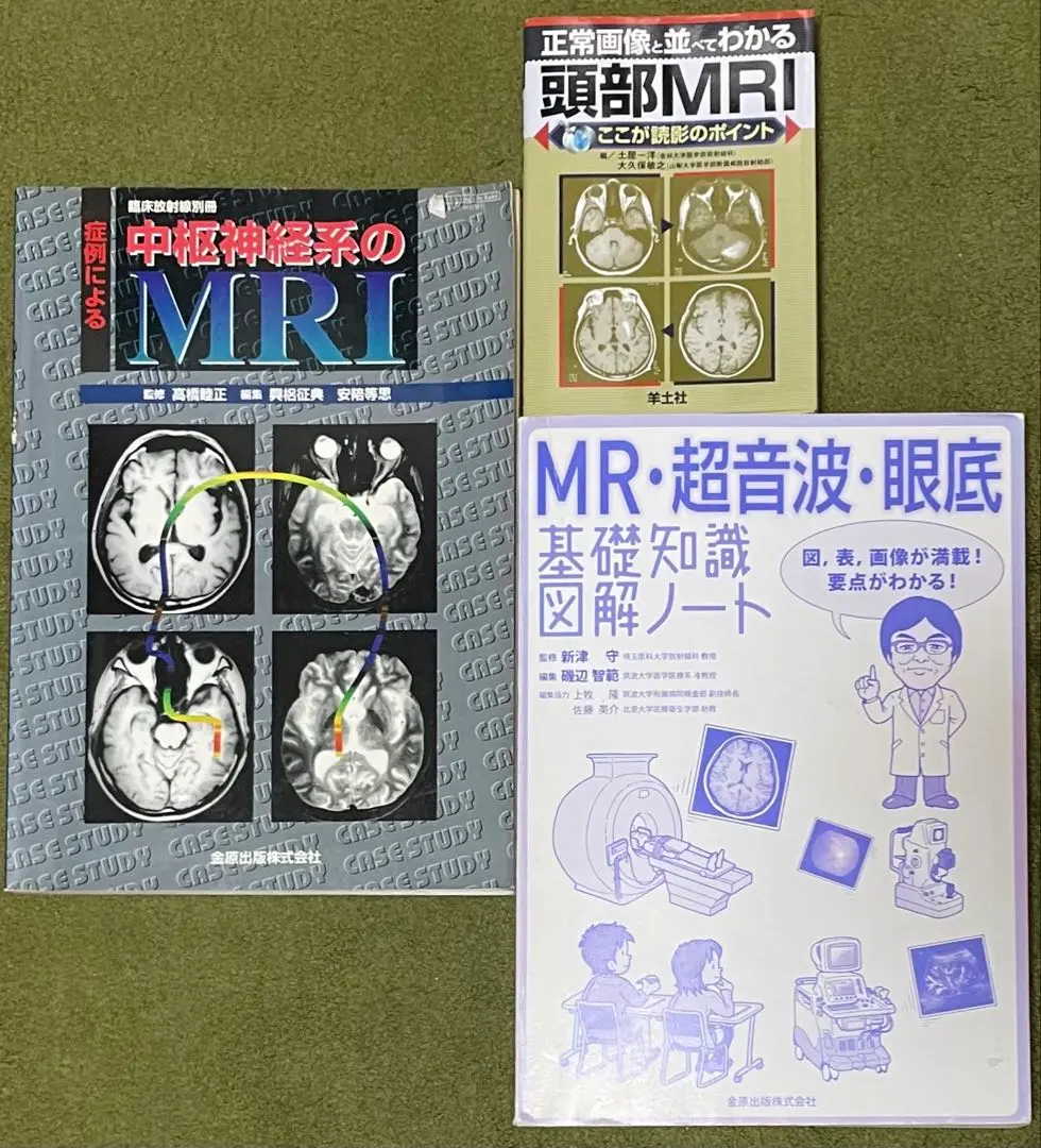 モ*コ様 【補訂版‼️】 MR・超音波・眼底 基礎知識図解ノート 第2版補訂版 MR・超音波・眼底 基礎知識図解ノート 第2版補訂版 | 新津 守