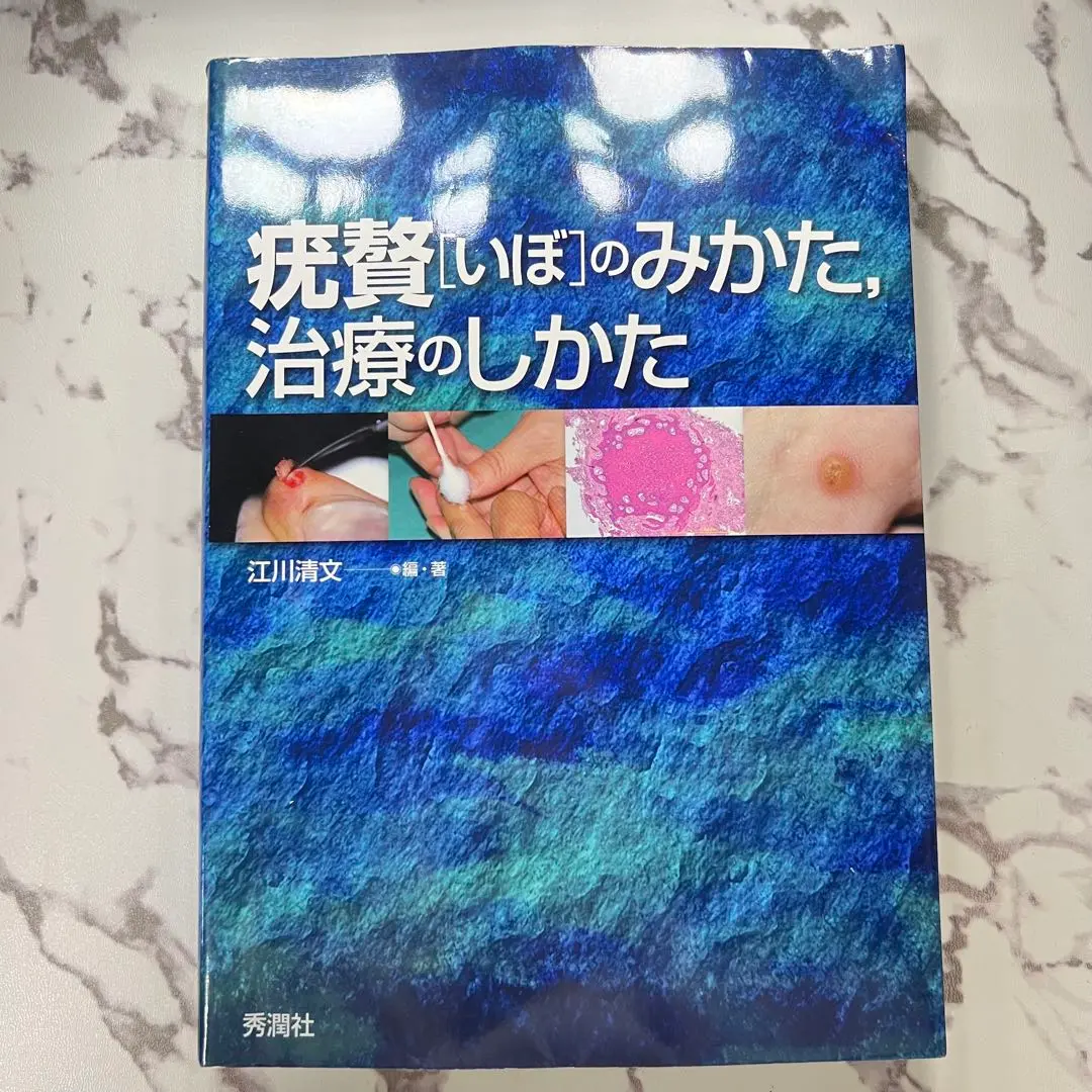 裁断済】疣贅のみかた、治療のしかた