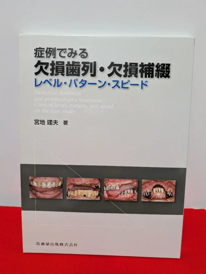 症例でみる欠損歯列・欠損補綴レベル・パターン・スピード