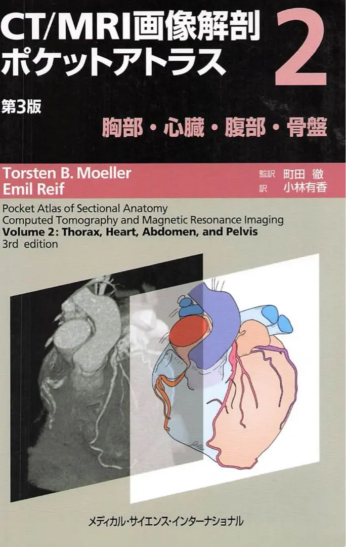 腹部のCT 第3版 腹部のCT 第3版 | 陣崎雅弘 |本 | 通販 | Amazon