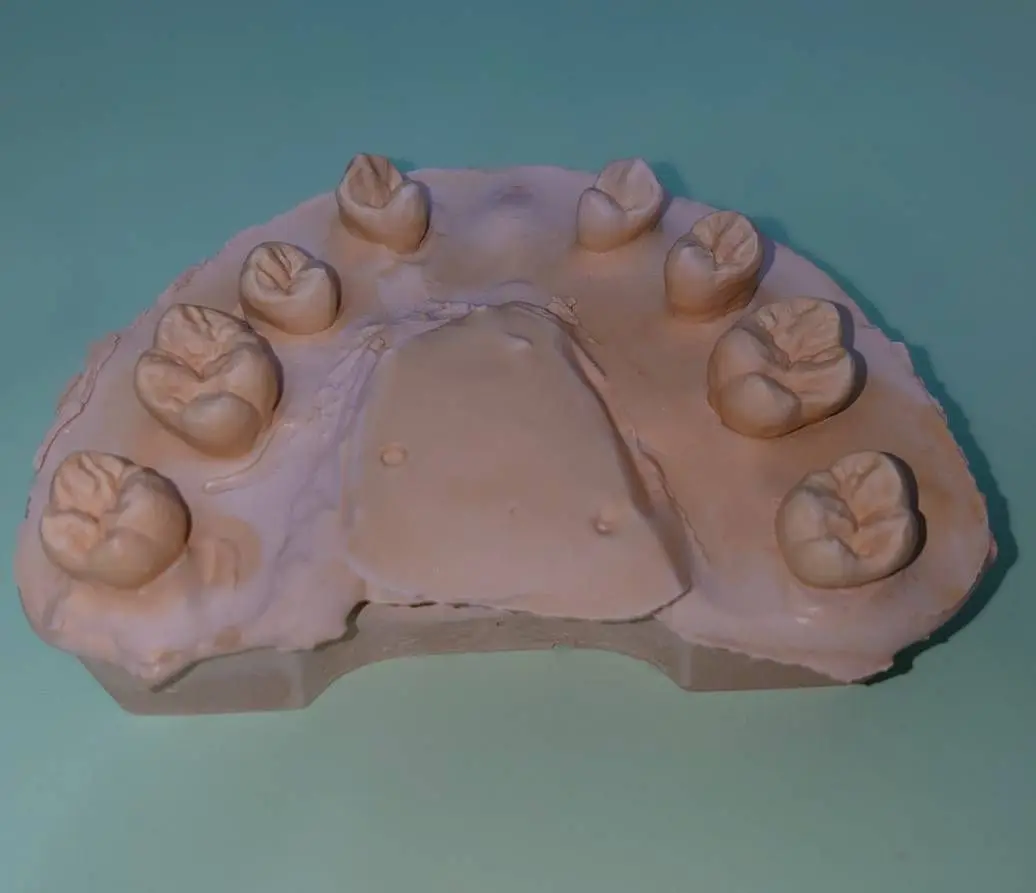 歯科 ZERO別冊 歯牙形態 Natural Tooth Morphology 歯科 ZERO別冊 歯牙形態 Natural Tooth Morphology