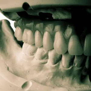 新品裁断済 THE ALIGNER ORTHO アライナー矯正治療の最適解 - メルカリ