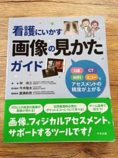看護にいかす画像の見かたガイドのサムネイル