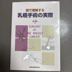 図で理解する乳癌手術の実際のサムネイル