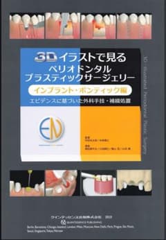 インプラント編　3Dイラストで見るペリオドンタルプラスティックサージェリーのサムネイル