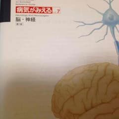 病気が見えるシリーズ 脳、神経のサムネイル