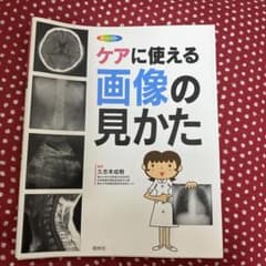 ケアに使える画像の見かた : X線写真・CT画像・エコー像・MRIのサムネイル