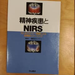 コ*ー様 精神疾患とNIRS 光トポグラフィー検査による脳機能イメージングのサムネイル