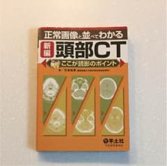 正常画像と並べてわかる頭部CT  羊土社のサムネイル