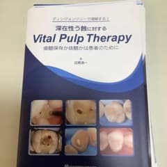 歯科　裁断済み　深在性う蝕に対するVital Pulp Therapyのサムネイル