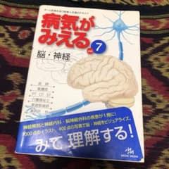 病気がみえる vol.7 (脳・神経)のサムネイル