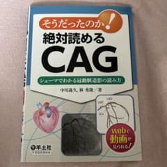 そうだったのか！絶対読めるCAG シェーマでわかる冠動脈造影の読み方のサムネイル