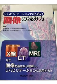 リハビリテーションのための画像の読み方のサムネイル