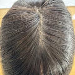 私元気　私げんき　ウィッグ　ヘアピースのサムネイル