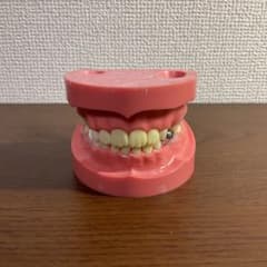 混合歯列顎模型 ニッシン - メルカリ