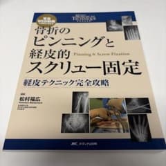骨折のピンニングと経皮的スクリュー固定 : 経皮テクニック完全攻略