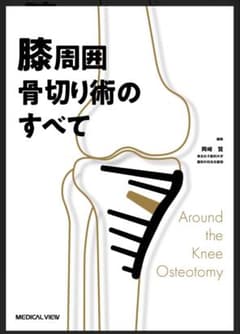 膝周囲骨切り術のすべて Around the Knee Osteotomyのサムネイル