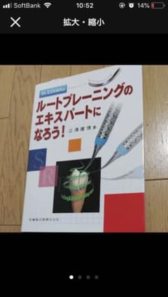 ルートプレーニングのサムネイル