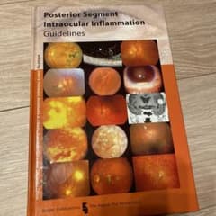 P intraocular infjlammation guidelineのサムネイル