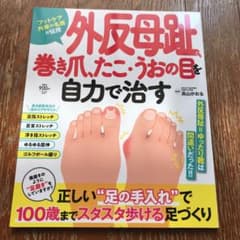 外反母趾、巻き爪、たこ・うおの目を自力で治すのサムネイル
