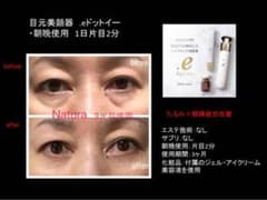 ドットイー .e ナトゥーラ 美眼器 目元美顔器 ディレイアゼル 一度使用のサムネイル