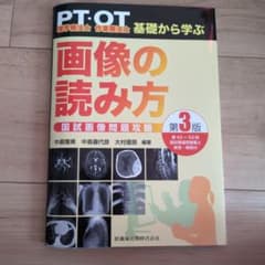 PT・OT基礎から学ぶ 画像の読み方 第3版のサムネイル
