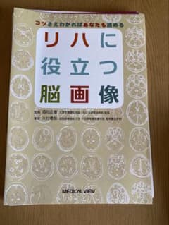 リハに役立つ脳画像のサムネイル