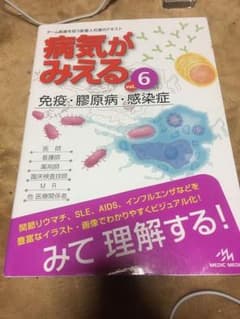 病気がみえる vol.6 (免疫・膠原病・感染症)のサムネイル