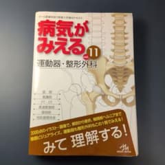 断裁済】病気がみえる vol.11 運動器・整形外科 - メルカリ