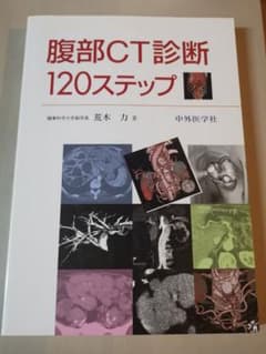 腹部CT診断120ステップのサムネイル
