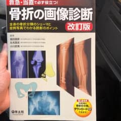 骨折の画像診断 : 救急・当直で必ず役立つ! : 全身の骨折分類のシェーマと症…のサムネイル