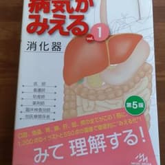 病気がみえる vol.1 消化器のサムネイル