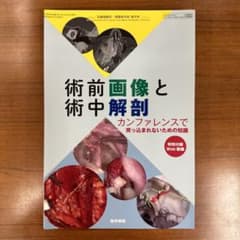 【裁断済み】術前画像と術中解剖カンファレンスで突っ込まれないための知識 術前画像と術中解剖 カンファレンスで突っ込まれないための知識【裁断