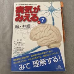 病気がみえる vol.7 脳・神経のサムネイル
