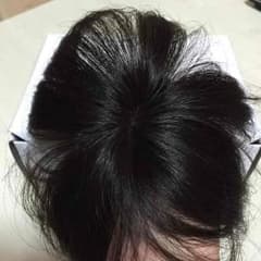 新品！ミニつむじヘアピースワイド『ともみ様専用』のサムネイル