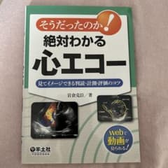 そうだったのか！絶対わかる心エコーのサムネイル
