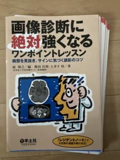 画像診断に絶対強くなるワンポイントレッスン 病態を見抜き、サインに気づく読影の…のサムネイル