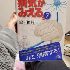 病気がみえる vol.7 (脳・神経)のサムネイル