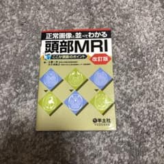 正常画像と並べてわかる頭部MRI : ここが読影のポイントのサムネイル