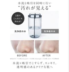 NIPLUX Multi Skin Cleaner 毛穴洗浄 美顔器 - メルカリ