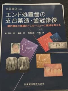 エンド処置歯の支台築造・歯冠修復 医歯薬出版のサムネイル