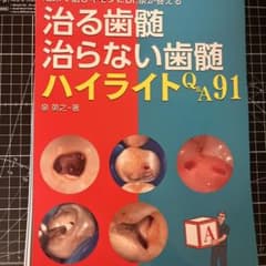 裁断済み 治る歯髄 治らない歯髄 ハイライトQ&A91 - メルカリ