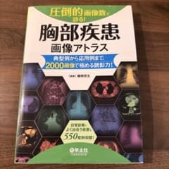 胸部疾患 画像アトラスのサムネイル