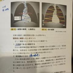 ICUビジュアルナーシング 見てできる臨床ケア図鑑のサムネイル