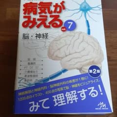 病気がみえる vol.7 脳・神経のサムネイル